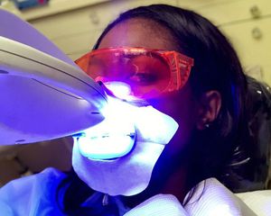 laser teeth whitening