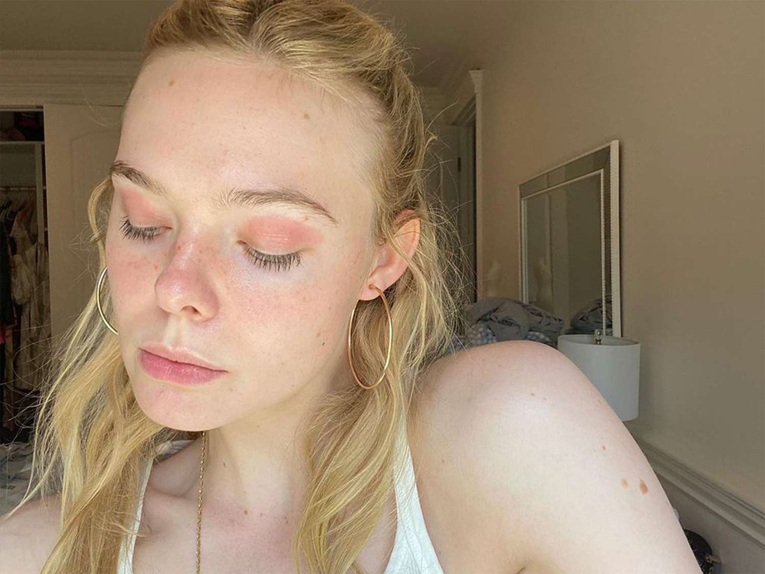 Elle Fanning with eczema on her eyelids