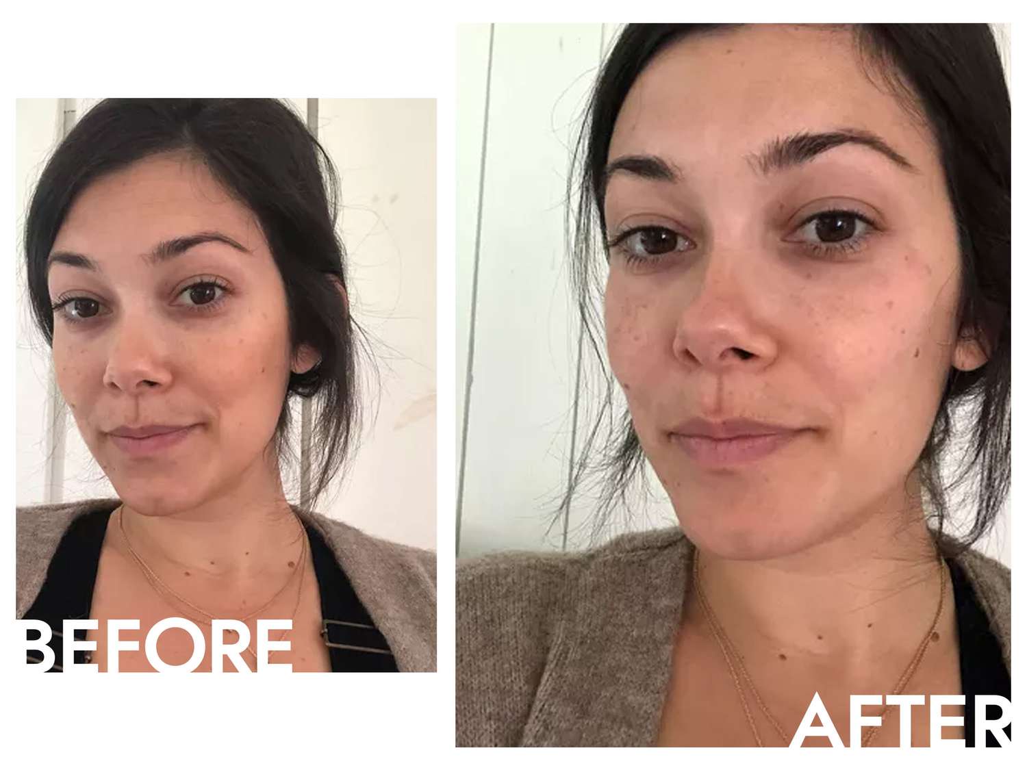 farmacy cleansing balm before and after