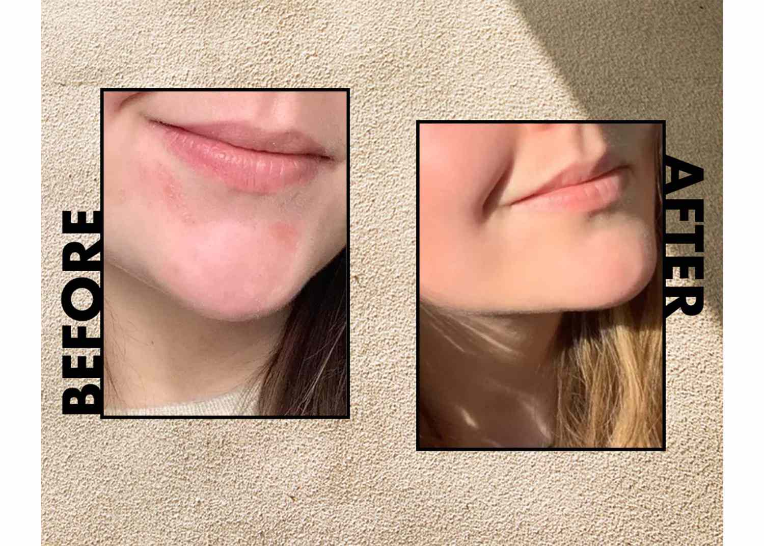 marula oil before and after photo