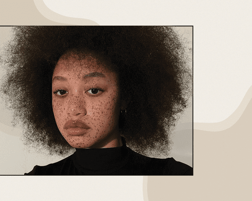 Portrait of BIPOC Woman with Natural Hair and Freckles Speckled Across Her Face