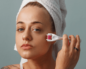 Close up of a woman using a derma-roller on her cheek